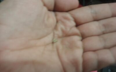5 Proven Ways to Prevent Kidney Stones Naturally